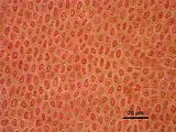 6 - Cellule corticali in visione superficiale